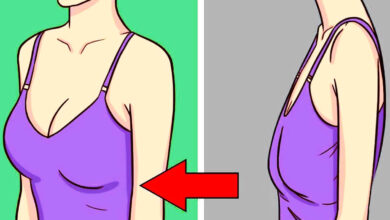 علاج ترهلات الثدي عند النساء