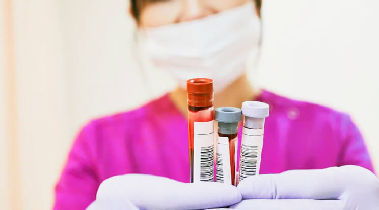 اختبارات الدم التي يجب على أي شخص القيام بها - اختبارات تخثر الدم