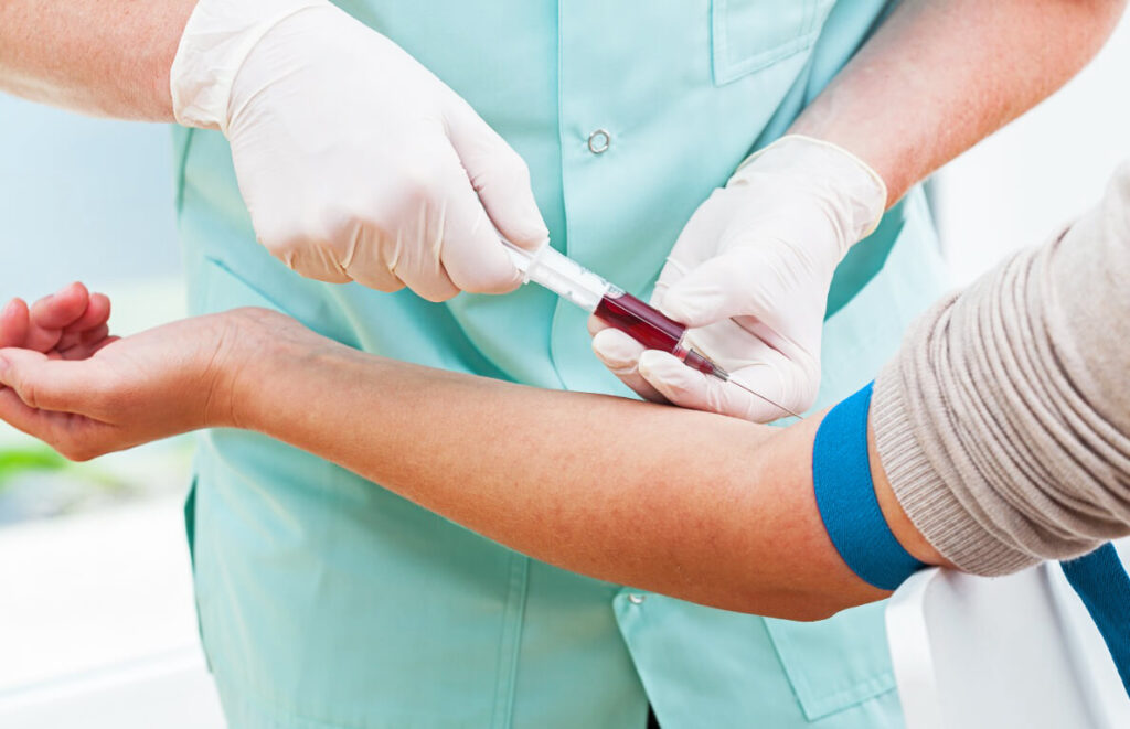 اختبارات الدم التي يجب على أي شخص القيام بها - لوحة التمثيل الغذائي الأساسية