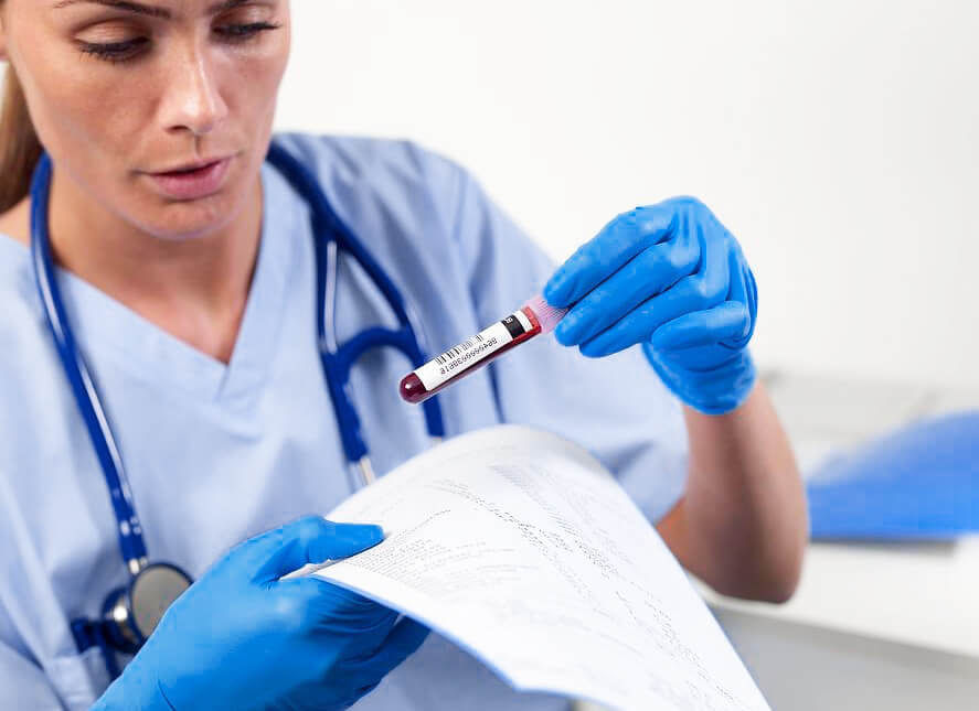 اختبارات الدم التي يجب على أي شخص القيام بها - كم من الوقت قد تستغرق النتائج؟