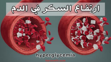 ارتفاع نسبة السكر في الدم | الأسباب والعوامل المساهمة في ذلك haronefit