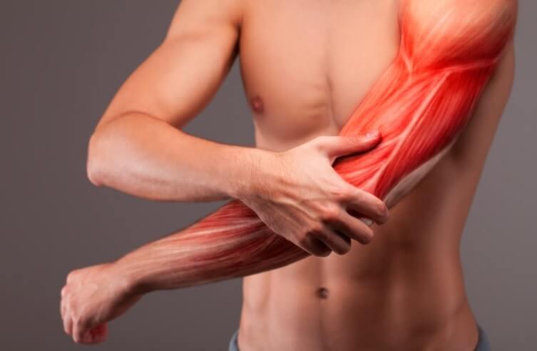 باب ضعف العضلات: الألم العضلي الليفي
