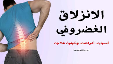 الانزلاق الغضروفي | الأعراض، الأسباب وهل يمكن علاجه؟ haronefit